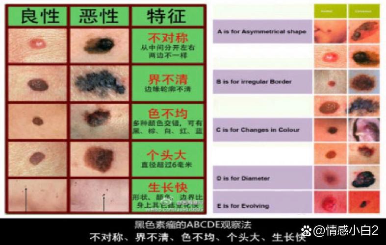 新门内部资料最快更新和患瘤拒上夜班被开除与患瘤拒上夜班被开除有赔偿吗